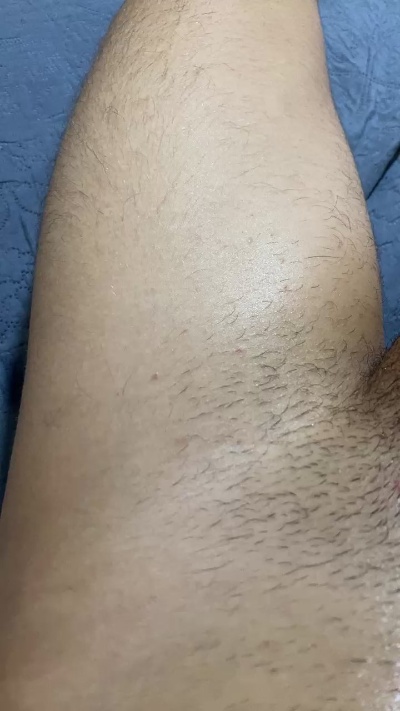 Infjb live from Brazil