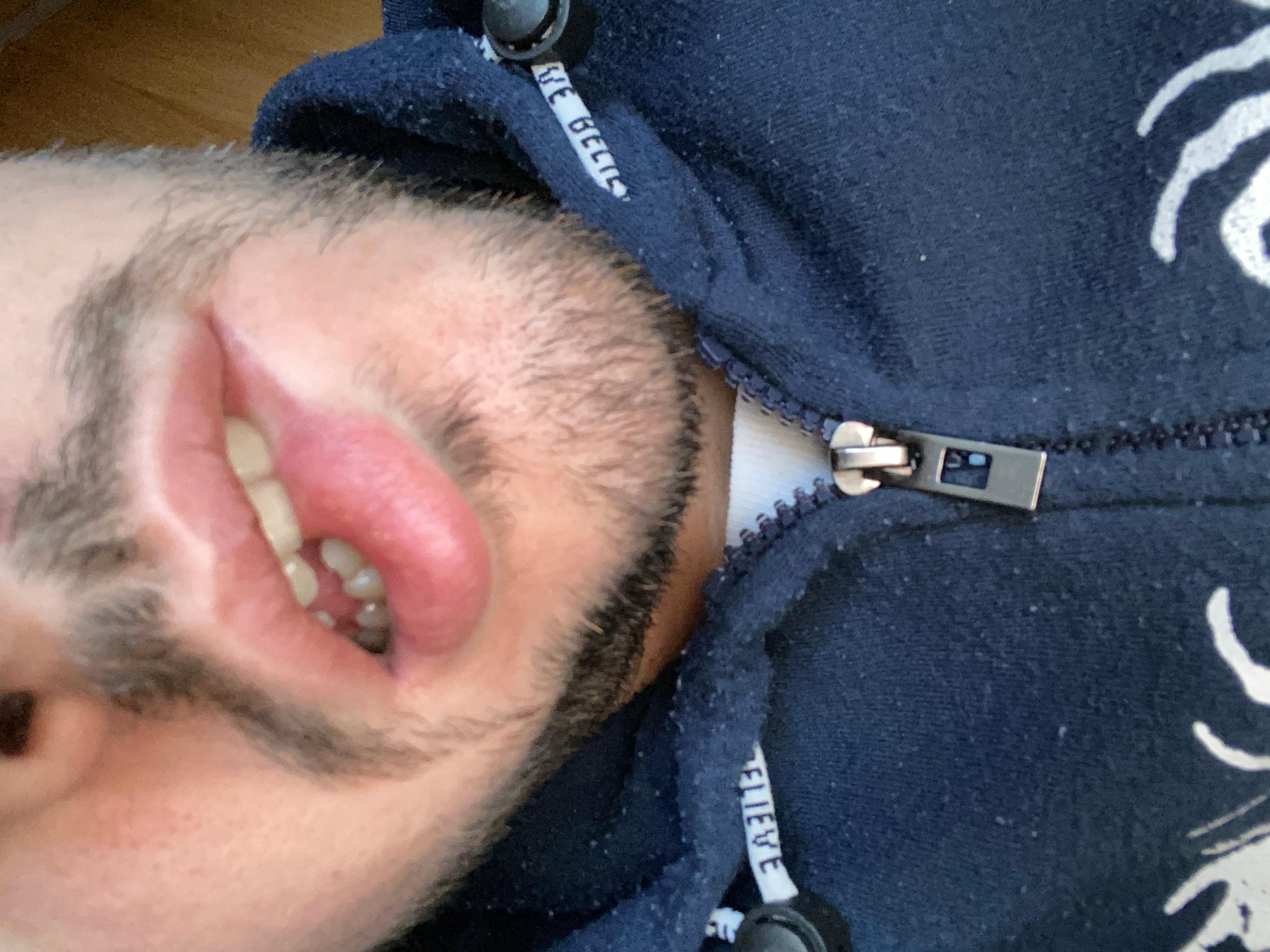 ale009911 live from Italy